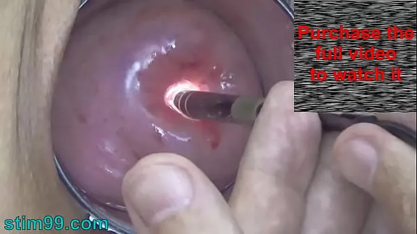 Paras Endoscope Camera inside Cervix Cam into Pussy Uterus hieno putki